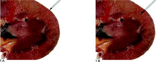 d-cell-culture-kidney-biopsy-culture