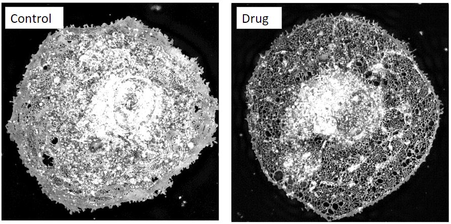 Liver_Fenestrations_Delivery_Szafranska_UoTromso.png