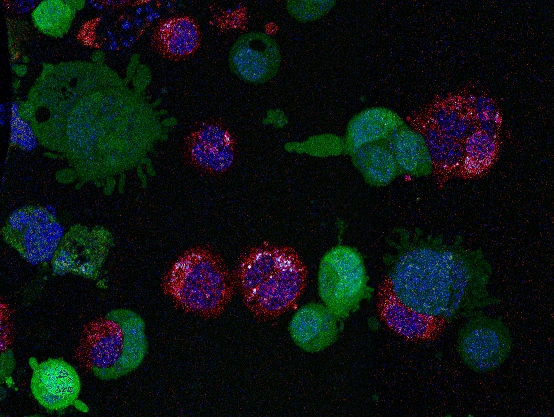 PLAST_CELL Metastaic cancer cells