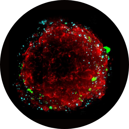 lung-spheroid-cherrybiotech