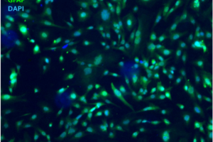 Astrocytes immortalized cell lines - Cherry_Biotech