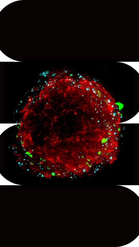 SSP - spheroids-3dcellculture